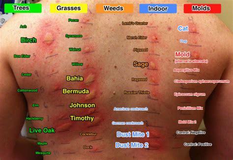 advil impact allergy tests|drugs that affect allergy skin testing.